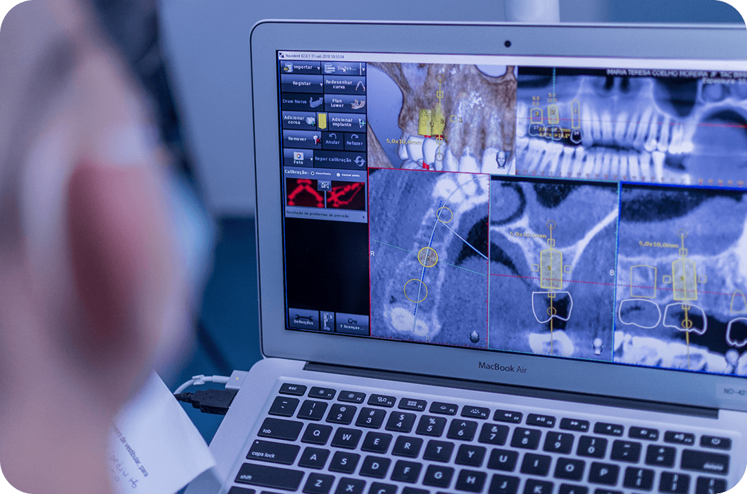 Rejuvenescimento Facial com CGF