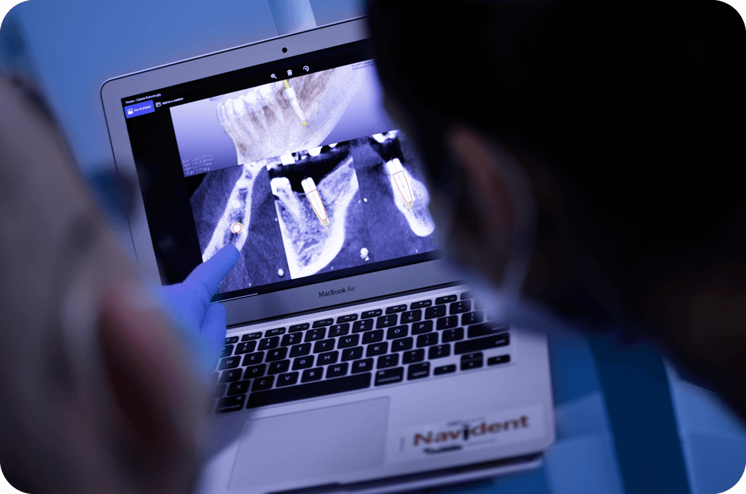 Rejuvenescimento Facial com CGF